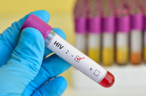 Tes HIV, Gratis tapi Minat Masyarakat Sedikit