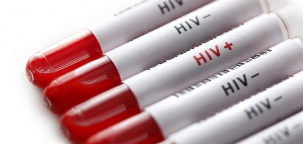 Berapa Umur Terbaik untuk Melakukan Tes HIV ?